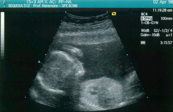 Tassilo on 2 April 98