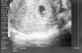 ULO on 23 Jan 98
